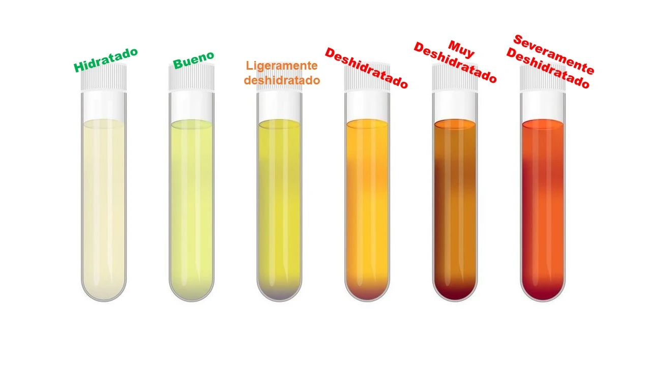 qué significan los diversos colores de la orina